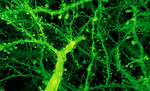Expansion Microscopy + Lattice Lightsheet for rapid mouse & fly brain synaptic imaging