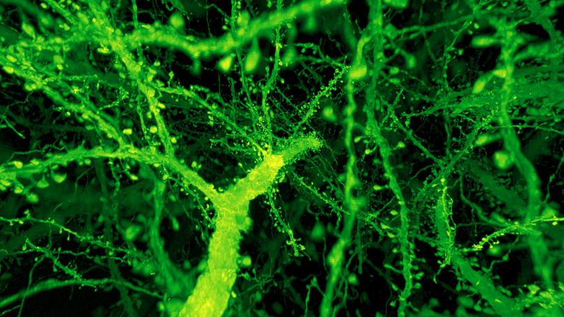 Expansion Microscopy + Lattice Lightsheet for rapid mouse & fly brain synaptic imaging
