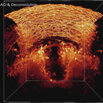 Two-photon, confocal + AO